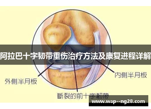 阿拉巴十字韧带重伤治疗方法及康复进程详解